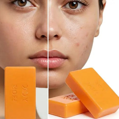 Papaya Soap Pack of 3 (100g Each)